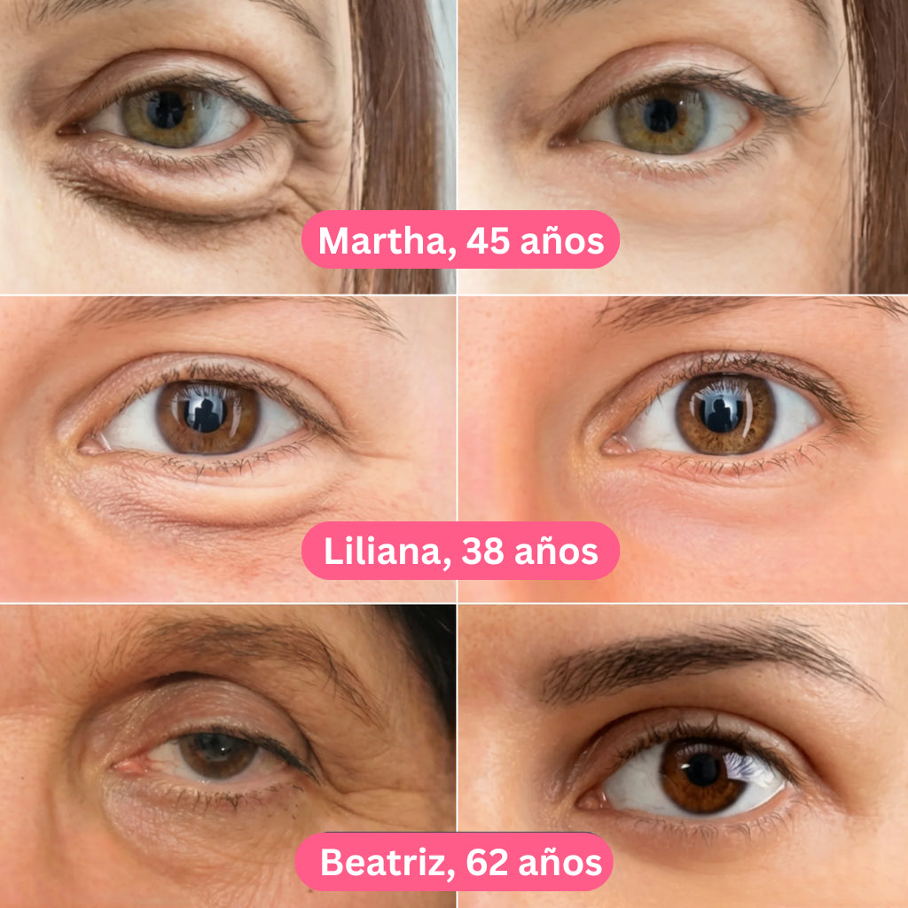 Oferta Especial 2x1: Parches de Colágeno Coreanos para eliminar las ojeras