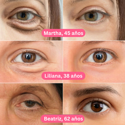 Oferta Especial 2x1: Parches de Colágeno Coreanos para eliminar las ojeras