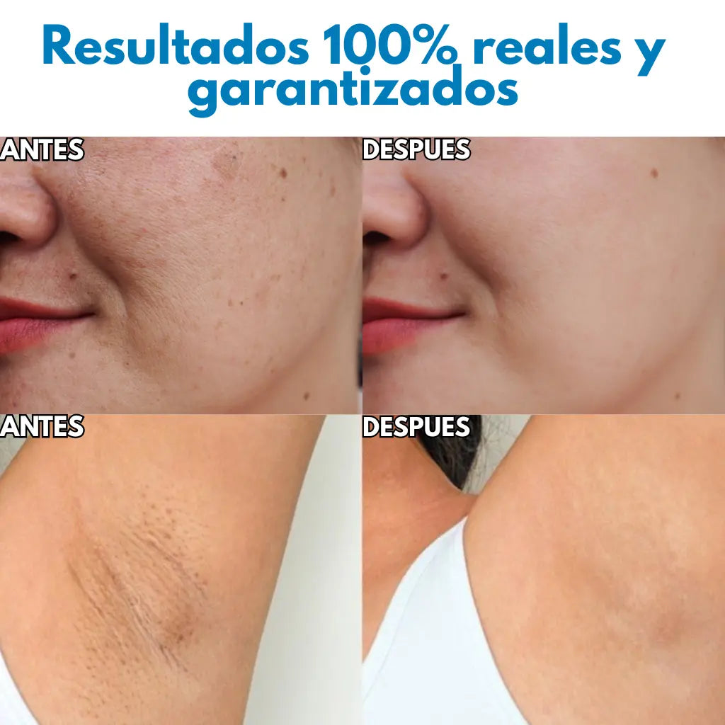 Dr. Melaxin™: Crema Dermatológica con Ácido Tranexámico y Niacinamida que Desmancha tu Piel