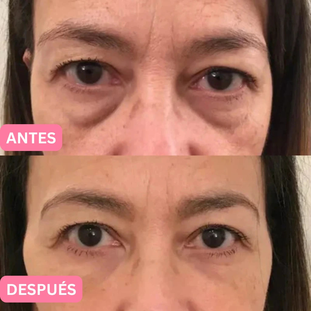 Oferta Especial 2x1: Parches de Colágeno Coreanos para eliminar las ojeras