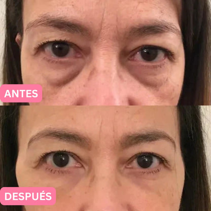 Oferta Especial 2x1: Parches de Colágeno Coreanos para eliminar las ojeras