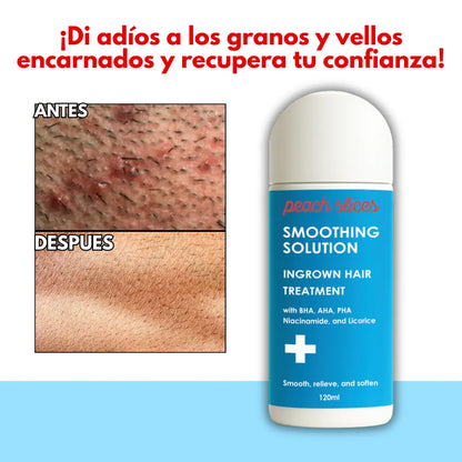 Peachslices™: Tratamiento Corporal para Vellos Encarnados