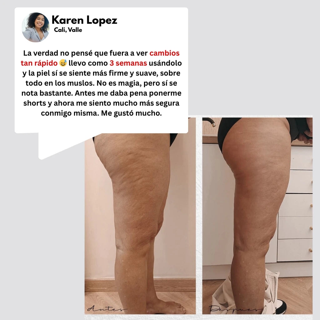 Aceite Reafirmante de Colageno Anti Celullite®