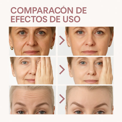 Bálsamo Hidratante Antiedad Kahi™