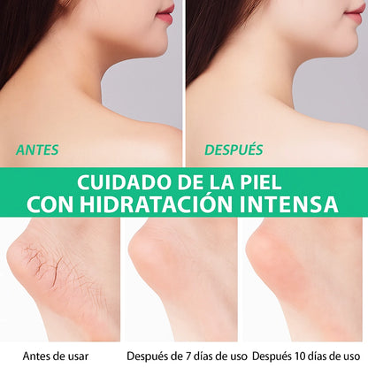 Crema UltraHidratante Urea®