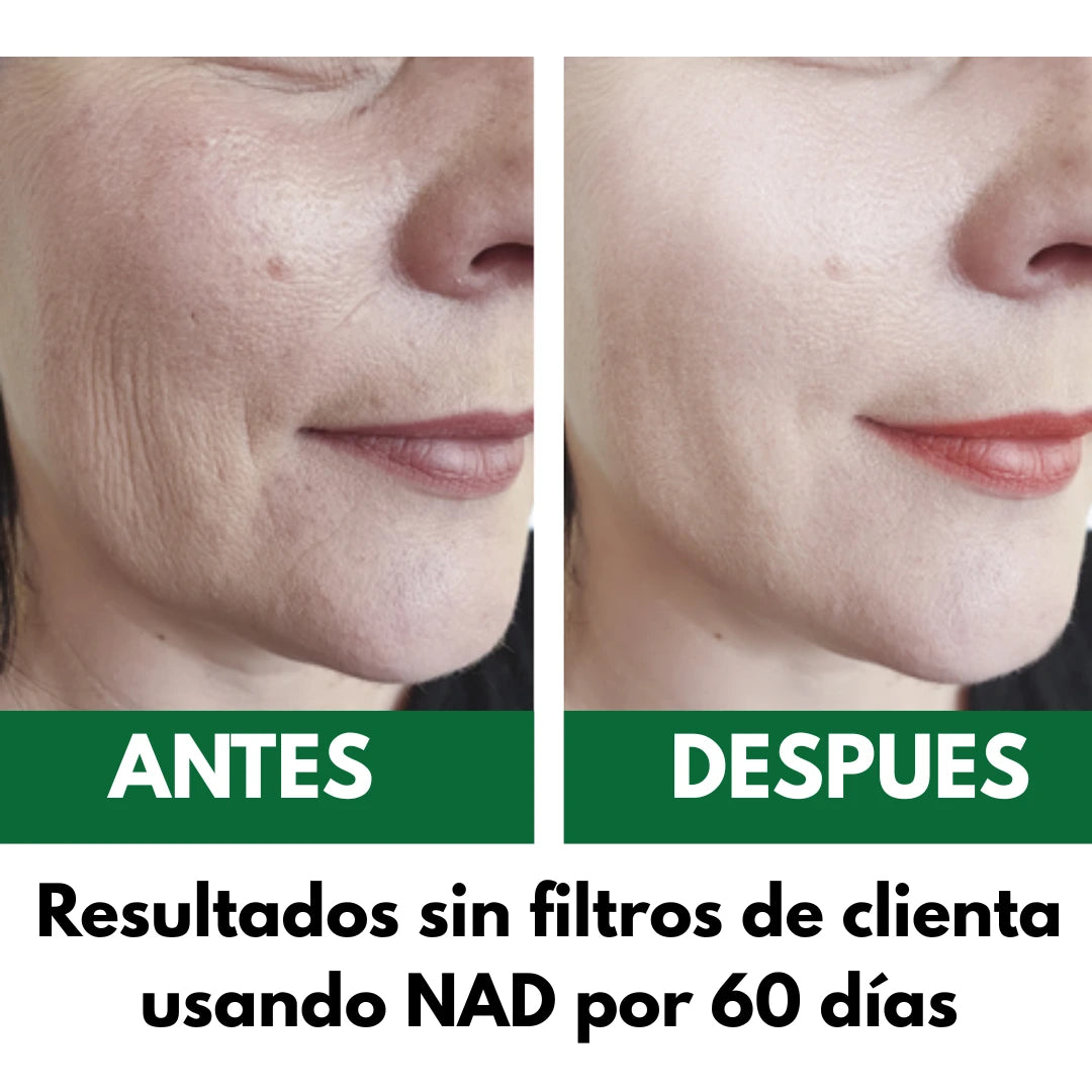NAD+ Catakor™:  Suplemento antienvejecimiento con soporte celular avanzado para combatir arrugas desde el interior.