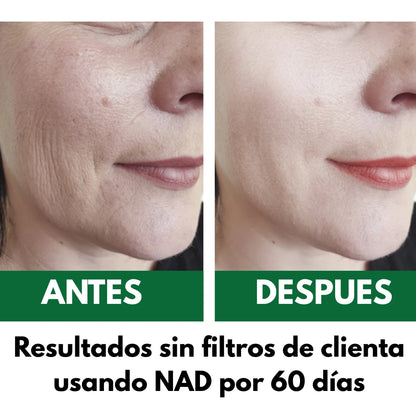 NAD+ Catakor™:  Suplemento antienvejecimiento con soporte celular avanzado para combatir arrugas desde el interior.